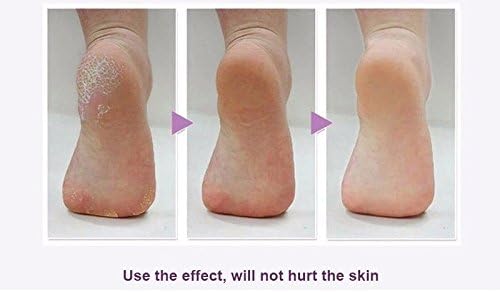 Removedor Exfoliante Piel Muerta Suave Full Body Eléctrico®