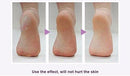 Removedor Exfoliante Piel Muerta Suave Full Body Eléctrico®