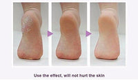 Removedor Exfoliante Piel Muerta Suave Full Body Eléctrico®